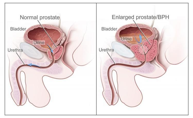 Dr. Thanki Prostrex powder