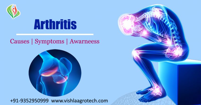 What Is Arthritis? - Symptoms and causes