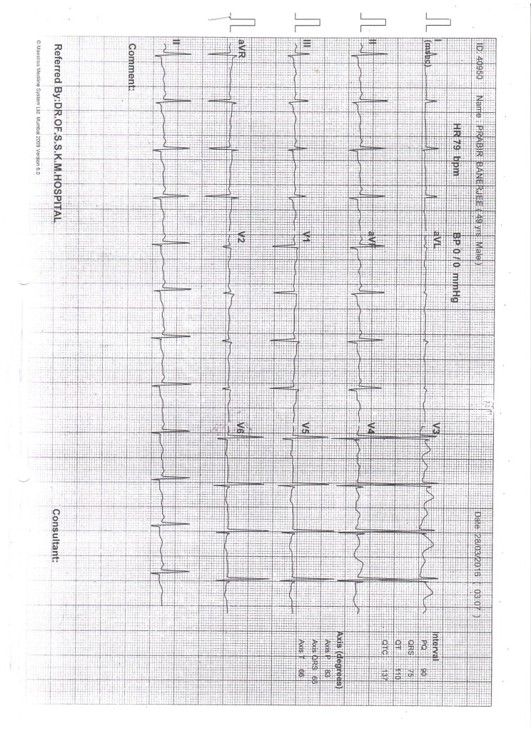 PRABIR-KUMAR-BANERJEE-48-Years-kidney-failure-treatment-10